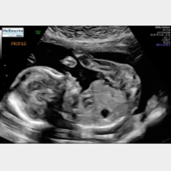 Babylist Registry Photo.