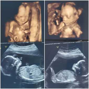 Babylist Registry Photo.