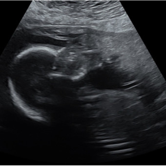 Babylist Registry Photo.