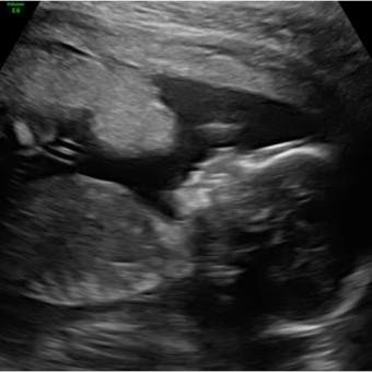 Babylist Registry Photo.