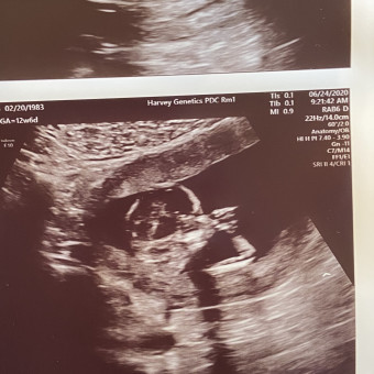 Babylist Registry Photo.