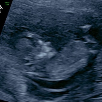 Babylist Registry Photo.