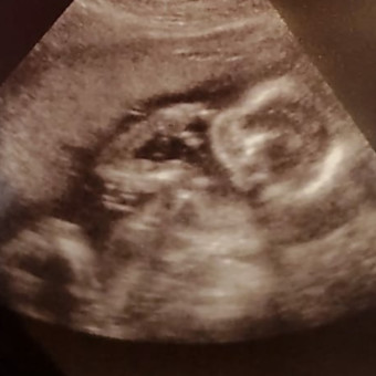 Babylist Registry Photo.