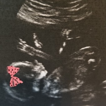 Babylist Registry Photo.