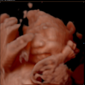 Babylist Registry Photo.