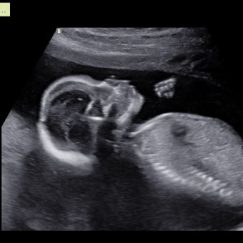 Babylist Registry Photo.