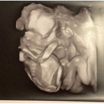 Babylist Registry Photo.