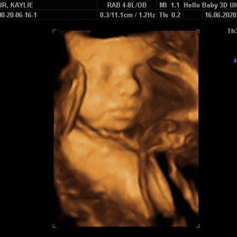 Babylist Registry Photo.