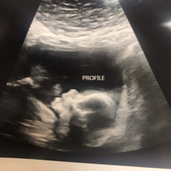 Babylist Registry Photo.