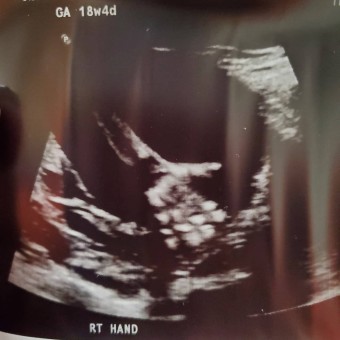Babylist Registry Photo.