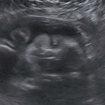 Babylist Registry Photo.