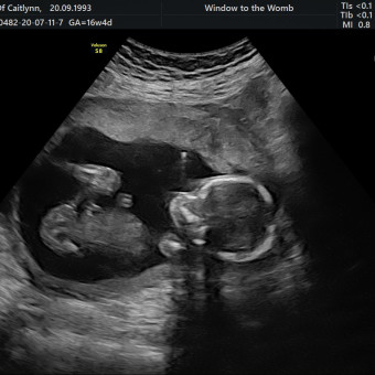 Babylist Registry Photo.
