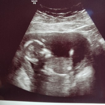 Babylist Registry Photo.