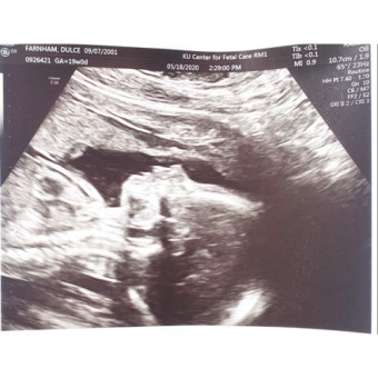 Babylist Registry Photo.