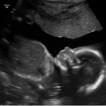 Babylist Registry Photo.