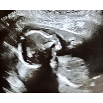 Babylist Registry Photo.