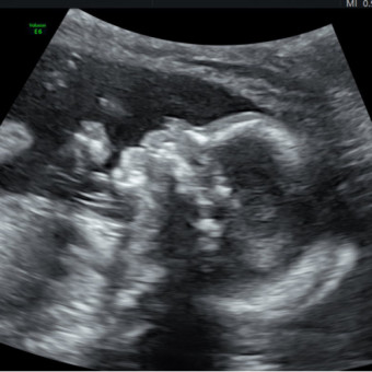 Babylist Registry Photo.