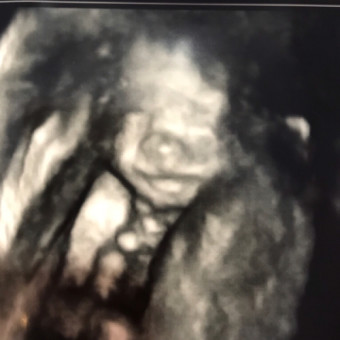 Babylist Registry Photo.