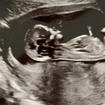 Babylist Registry Photo.