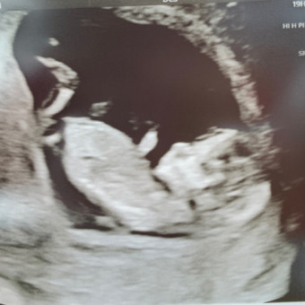 Babylist Registry Photo.