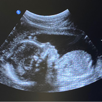 Babylist Registry Photo.