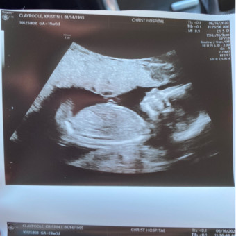 Babylist Registry Photo.