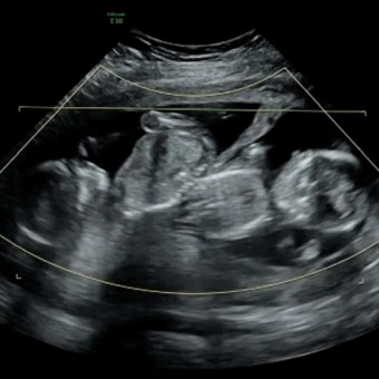 Babylist Registry Photo.
