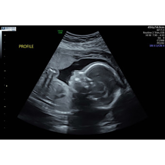 Babylist Registry Photo.