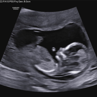 Babylist Registry Photo.