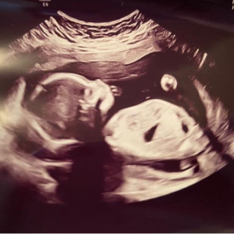 Babylist Registry Photo.