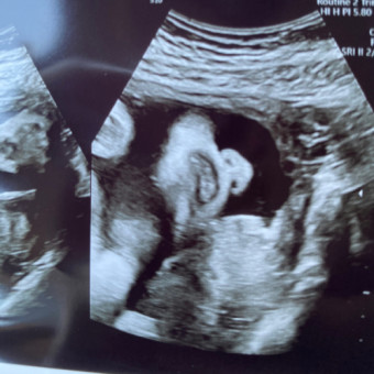 Babylist Registry Photo.
