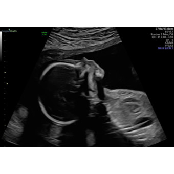Babylist Registry Photo.