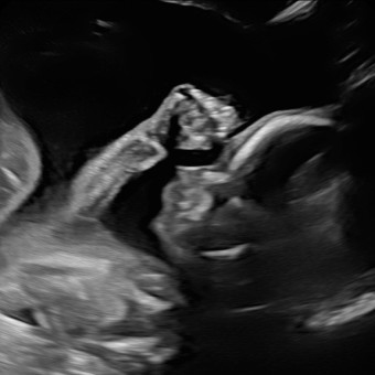 Babylist Registry Photo.
