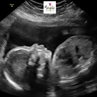 Babylist Registry Photo.