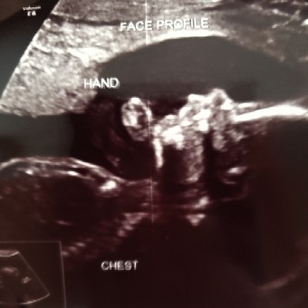 Babylist Registry Photo.
