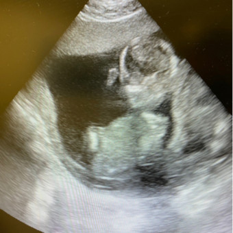Babylist Registry Photo.
