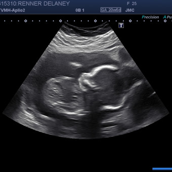 Babylist Registry Photo.