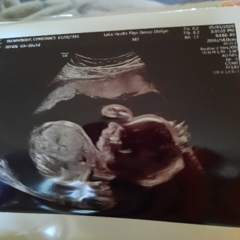 Babylist Registry Photo.