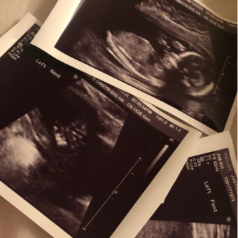Babylist Registry Photo.
