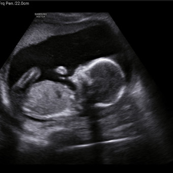 Babylist Registry Photo.