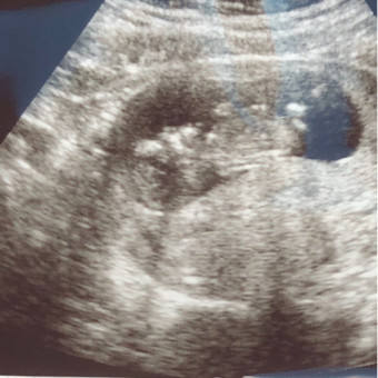 Babylist Registry Photo.