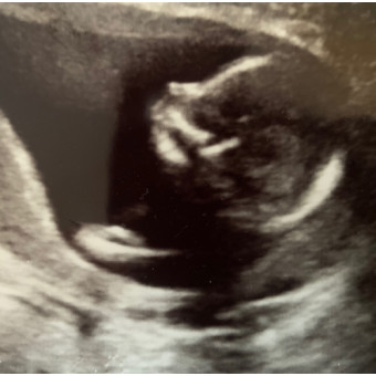 Babylist Registry Photo.