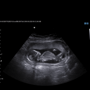 Babylist Registry Photo.