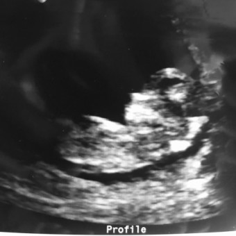 Babylist Registry Photo.
