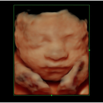 Babylist Registry Photo.