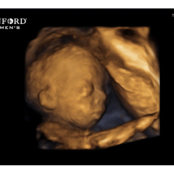 Babylist Registry Photo.