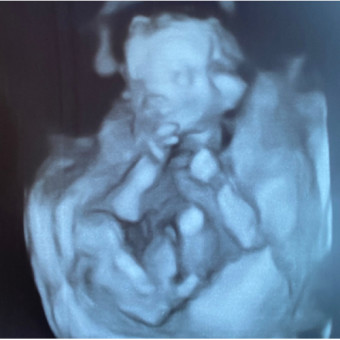 Babylist Registry Photo.