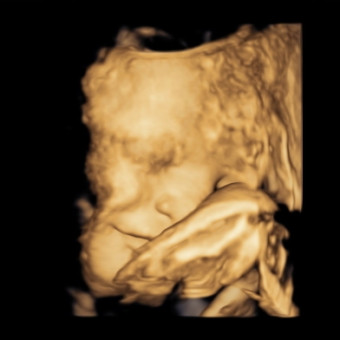 Babylist Registry Photo.