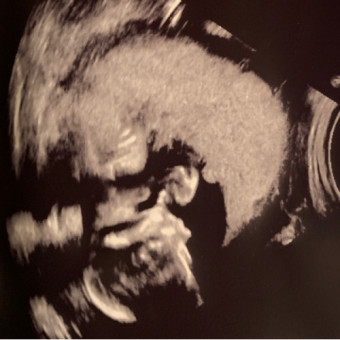 Babylist Registry Photo.