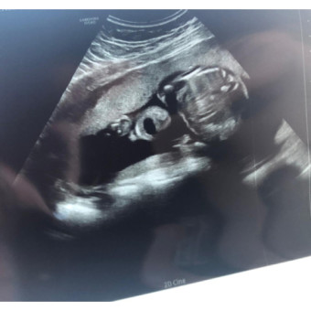 Babylist Registry Photo.